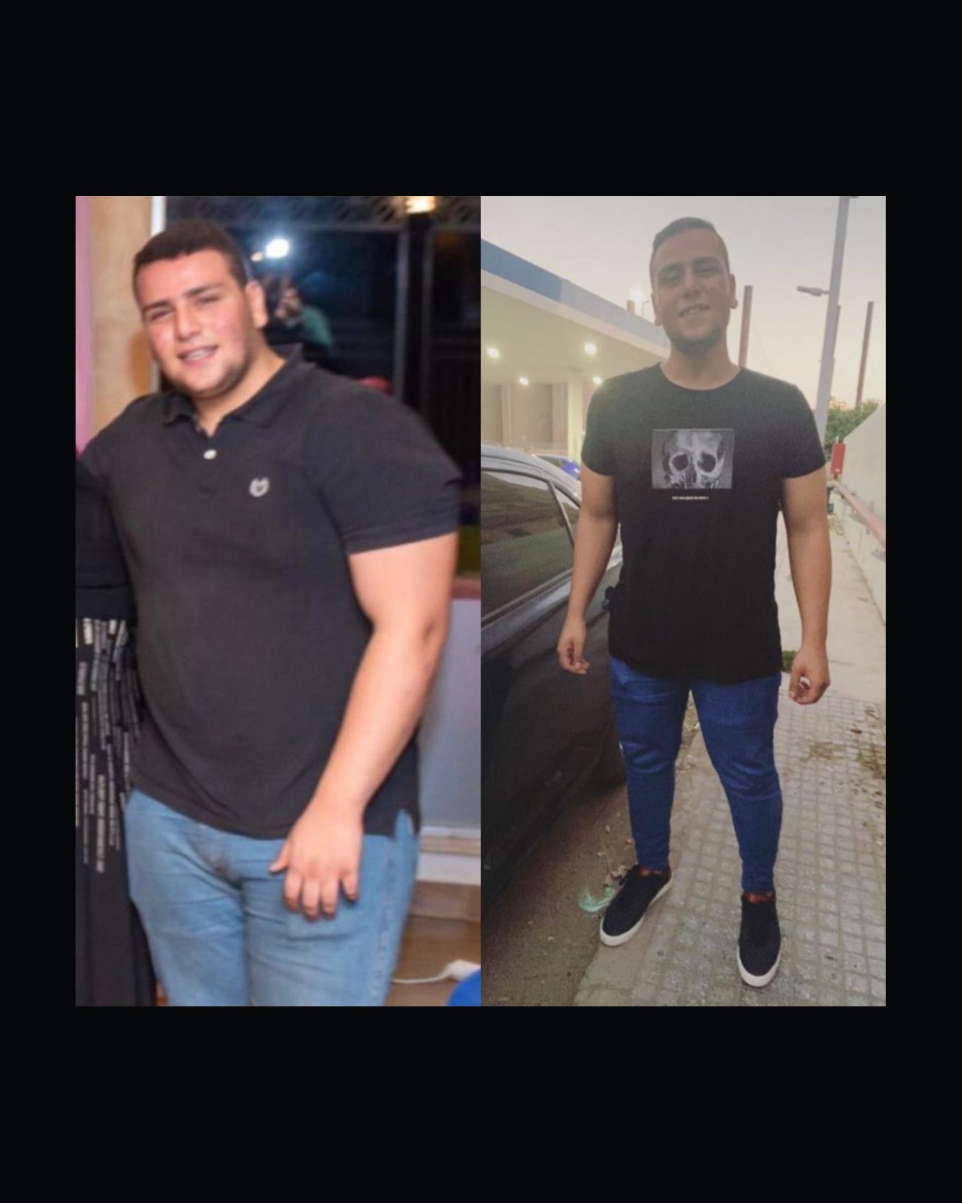 Before-and-after photo of client transformation number 4 coached by Adel El Biltagy